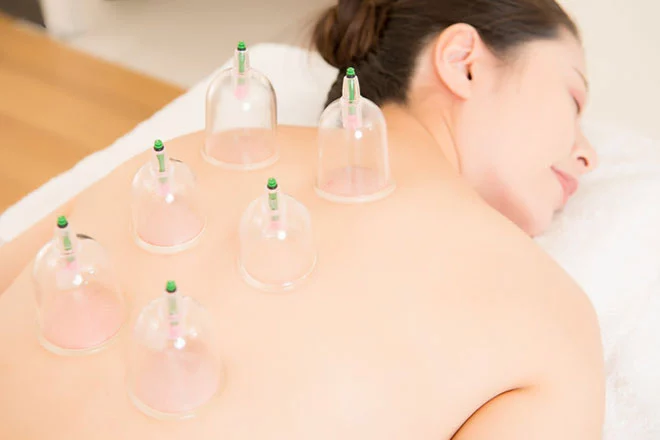 Cupping Therapy Downtown